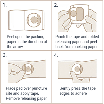 IV Pressure Pad